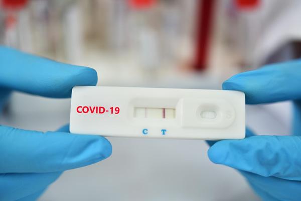 test rapidi dell’antigene test rapidi dell’antigene